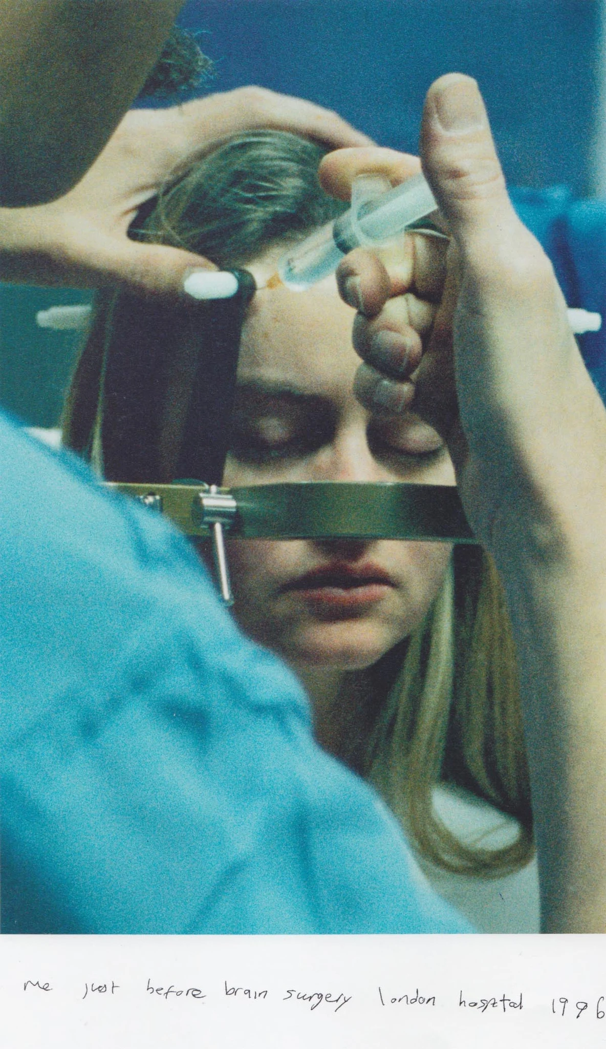Corinne Day z ramą stereotaktyczną podczas przygotowań do zabiegu neurochirurgicznego, Londyn, 1996; fotografia z odręcznym podpisem artystki.