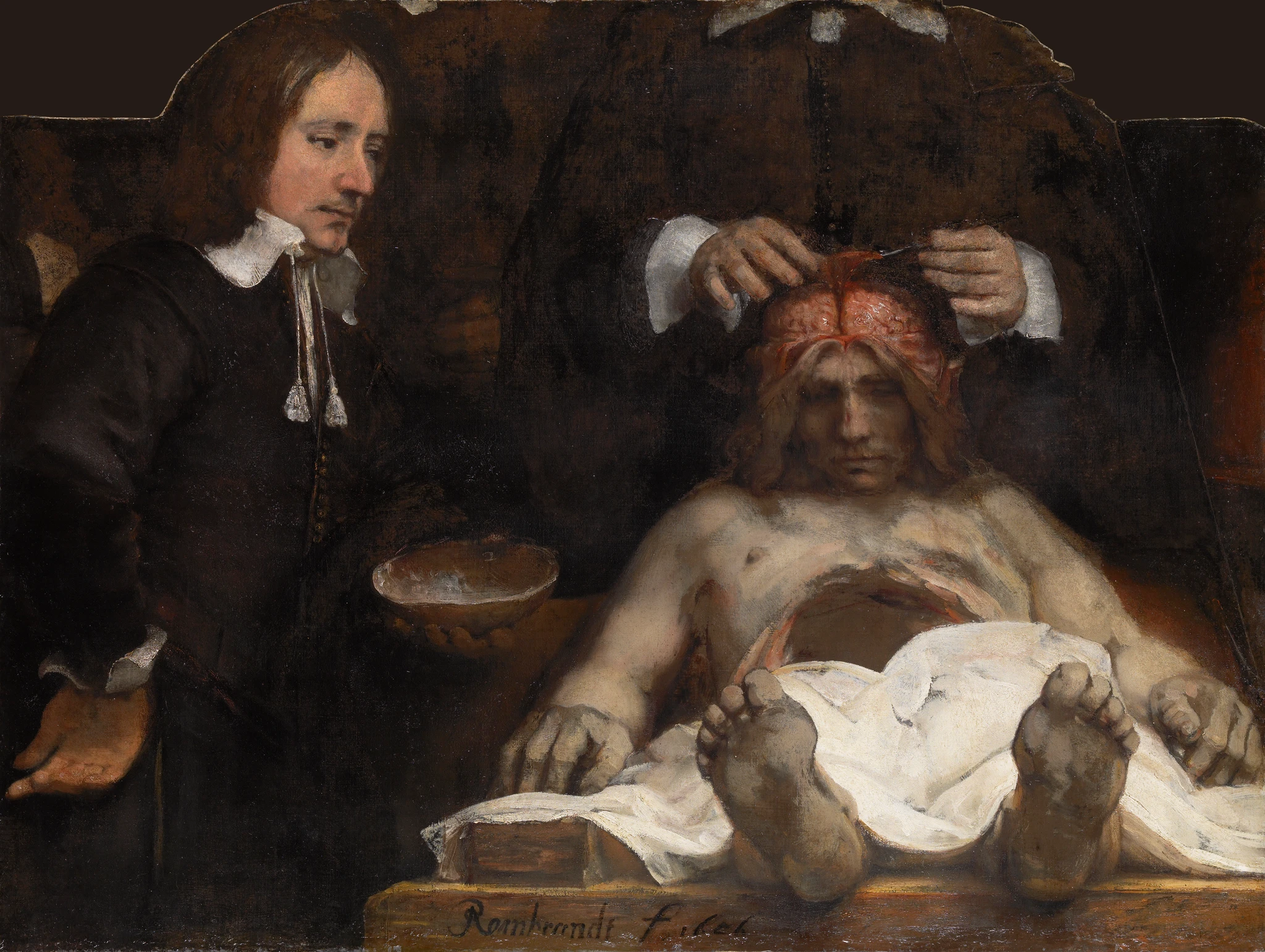 Rembrandt: sekcja mózgu zmarłego człowieka; asystent po lewej stronie trzyma zdjęte sklepienie czaszki.