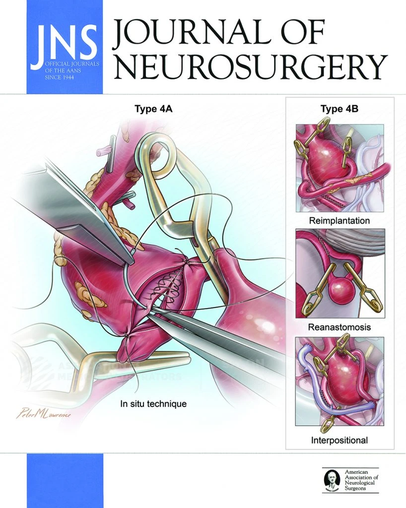 Okładka Journal of Neurosurgery z ilustracją Petera M. Lawrence’a przedstawiającą techniki zespalania naczyń mózgowych.